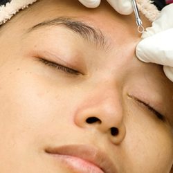 Acne Facial: What To Expect, Benefits, and More