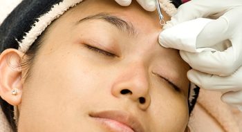 Acne Facial: What To Expect, Benefits, and More